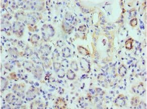 EPM2A / Laforin Antibody (aa244-331)