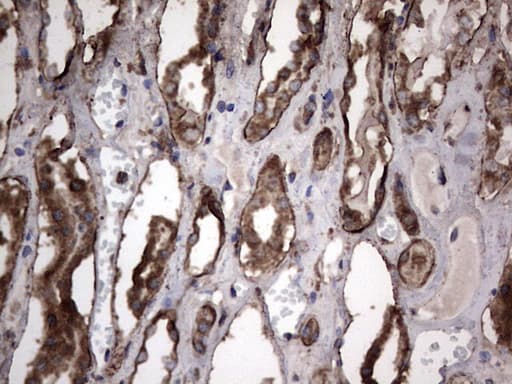 PKM2 Antibody (clone 14C7)