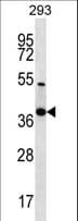 NKX2-2 Antibody (aa91-120)