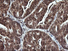 Monoclonal Mouse anti-Human LGALS3 / Galectin 3 Antibody (clone 1G8, Carrier-free, IHC, IF, WB)