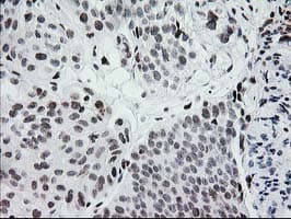 CRY2 Antibody (clone OTI1H5)