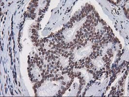 CTDSP1 / SCP1 Antibody (clone OTI1B6)