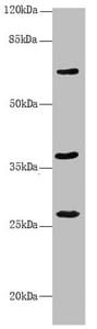 Polyclonal Rabbit anti-Human GNS Antibody (IHC, WB)