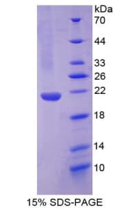 Mouse NGB / Neuroglobin Protein (Recombinant His, N-Terminal)