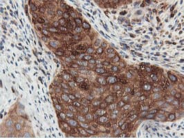 PFKP Antibody (clone OTI3G8, Carrier-free)