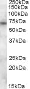 IHC-plus™ PMP70 Antibody (aa526-539)