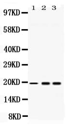 Polyclonal Rabbit anti-Human SUB1 Antibody (IHC, WB)