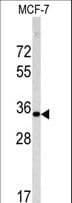 EMD / Emerin Antibody (aa187-213)