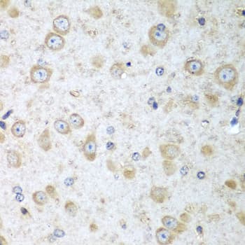 Polyclonal Rabbit anti-Human TRH / Thyrotropin Releasing Hormone Antibody (IHC, WB)