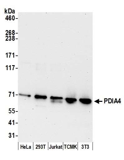 PDIA4 / ERP72 Antibody (aa595-645)