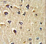 Polyclonal Rabbit anti-Human ALCAM / CD166 Antibody (aa58-87, IHC, WB)