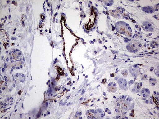 PECAM-1 / CD31 Antibody (clone UMAB164)