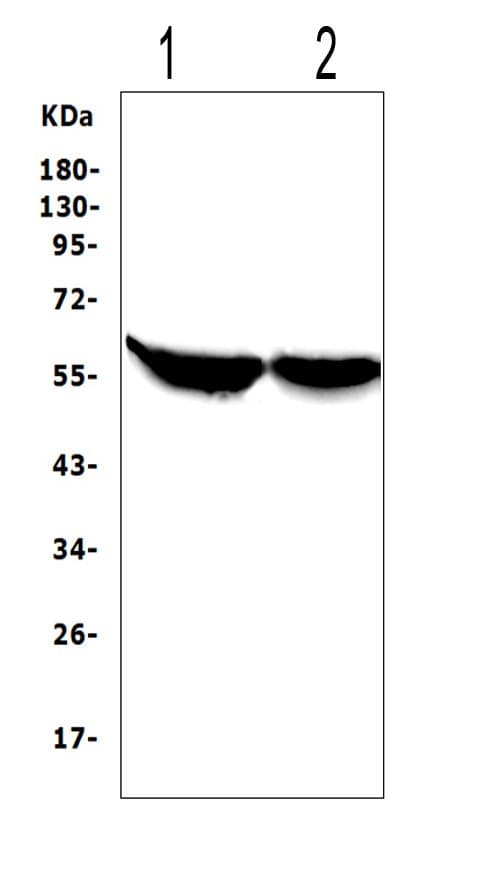 CYP2E1 Antibody (aa94-112)