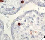 Monoclonal Mouse anti-Human Human Parvovirus Antibody (clone R92F6, IHC)