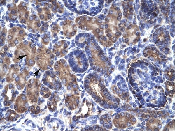 Polyclonal Rabbit anti-Human PSMD11 Antibody (aa276-325, IHC, WB)