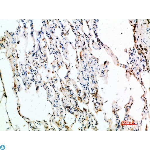 ASCL1 / MASH1 Antibody