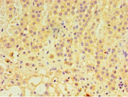 GTF2H2C Antibody (aa1-260)