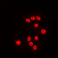 ATF7 Antibody (Internal)