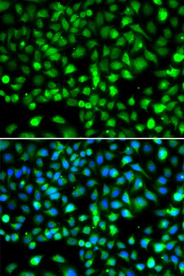 Polyclonal Rabbit anti-Human SMYD1 Antibody (IHC, IF, WB)