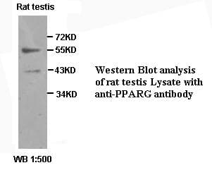 Polyclonal Rabbit anti-Human PPARG / PPAR Gamma Antibody (WB)