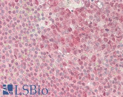 IHC-plus™ Polyclonal Rabbit anti-Human RAF1 / RAF Antibody (C-Terminus, IHC, IF, WB)