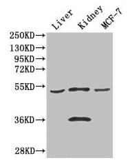 Corneodesmosin / CDSN Antibody