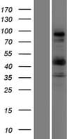 Human COL9A1 / Collagen IX Protein (Over-Expression Lysate Myc-DDK (Flag))