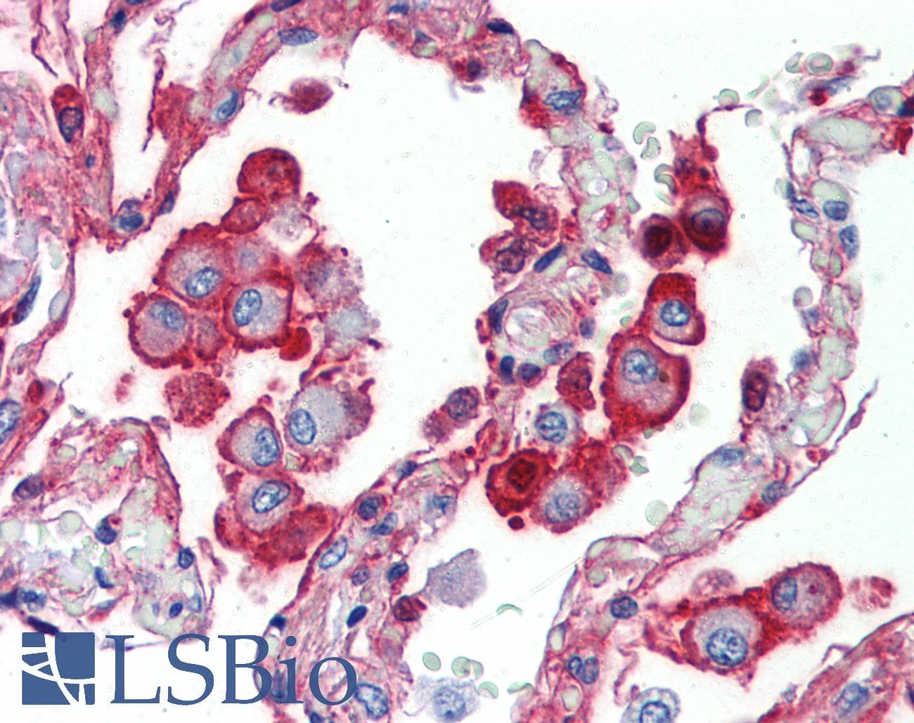 IHC-plus™ ALPL / Alkaline Phosphatase Antibody
