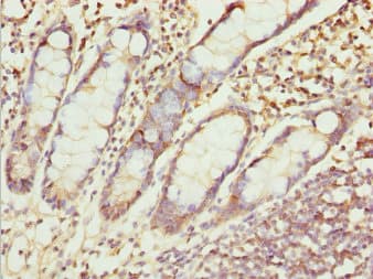 Polyclonal Rabbit anti-Human ZNF169 Antibody (IHC, WB)