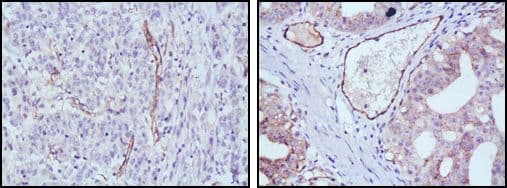 Monoclonal Mouse anti-Human NOS3 / eNOS Antibody (clone 6H2, IHC, WB)