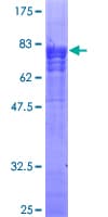 Human TAB1 Protein (Recombinant GST)