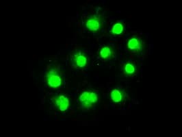ERCC1 Antibody (clone OTI1A3)
