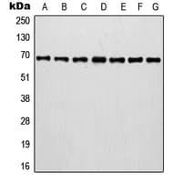 IVL / Involucrin Antibody (C-Terminus)