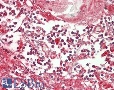 IHC-plus™ SND1 Antibody (aa100-150)