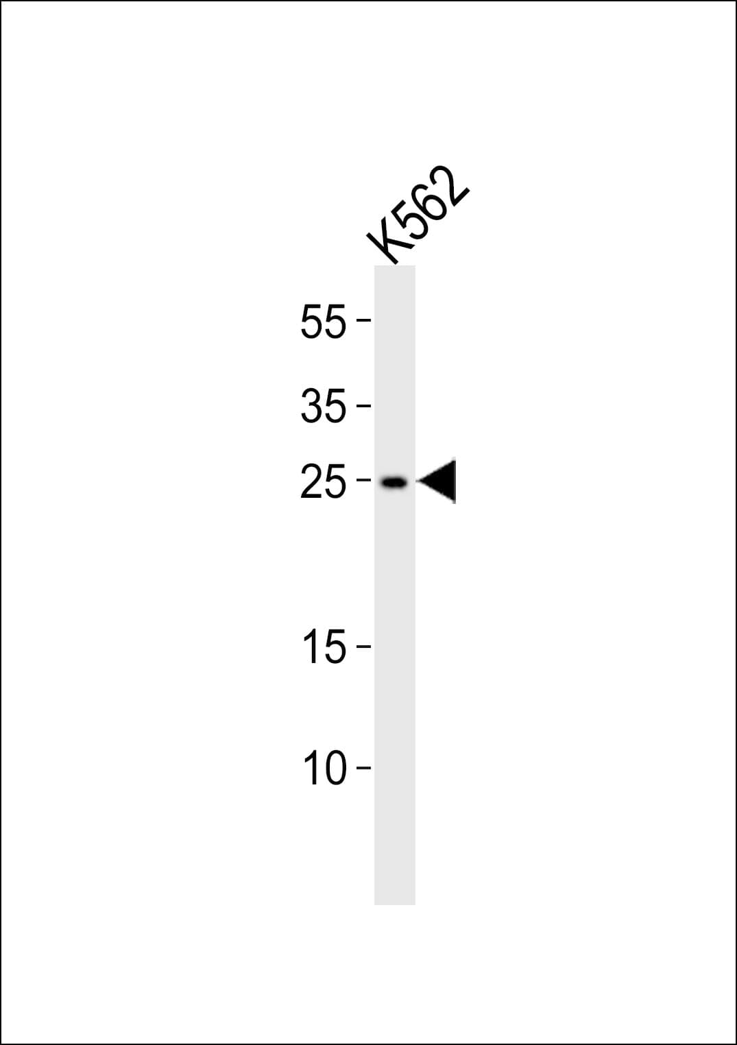 RAB27A / RAB27 Antibody (aa136-164)
