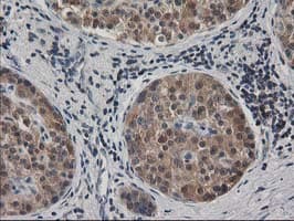 MAPRE2 / EB2 Antibody (clone OTI1D10)