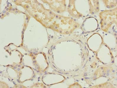 FAM118A Antibody