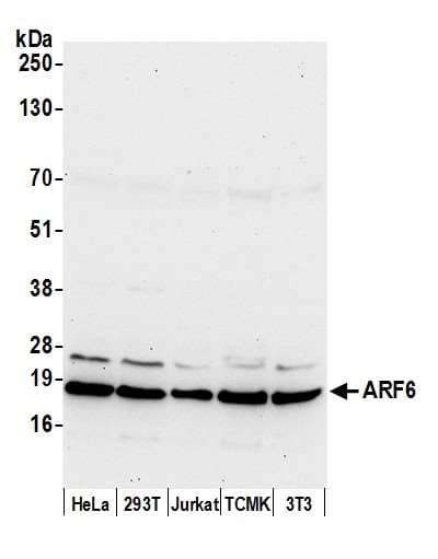 ARF6 Antibody (aa125-175)