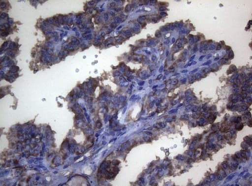 LGALS3 / Galectin 3 Antibody (clone OTI8E3)