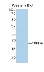 DLK1 / Pref-1 Antibody (aa177-326)