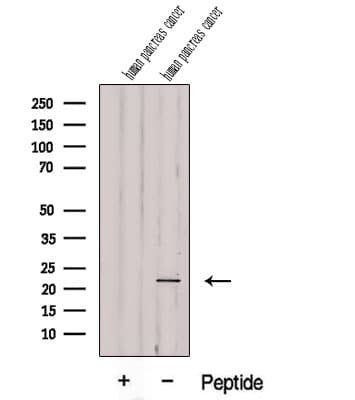 REDD-2 / DDIT4L Antibody