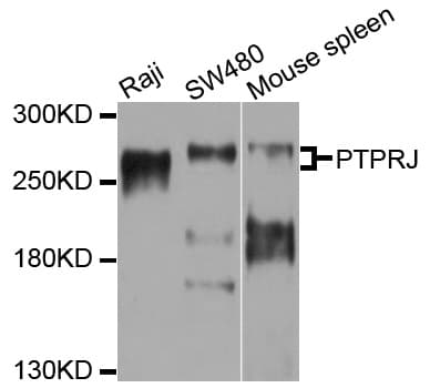 IHC-plus™ PTPRJ / CD148 Antibody