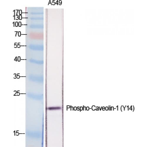 CAV1 / Caveolin 1 Antibody (1-80 aa)