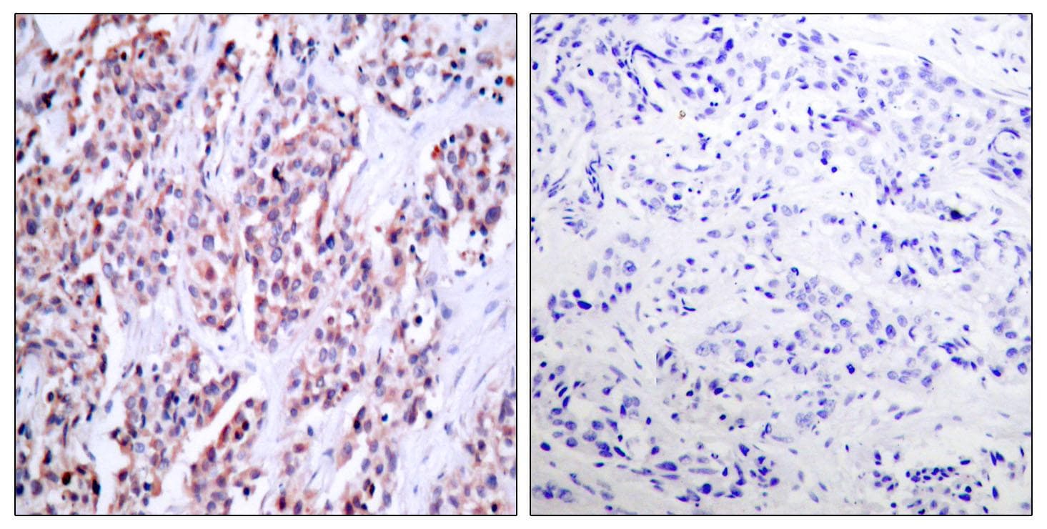 Polyclonal Rabbit anti-Human NFKB2 Antibody (p869, IHC, WB)