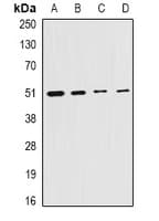 CS / Citrate Synthase Antibody