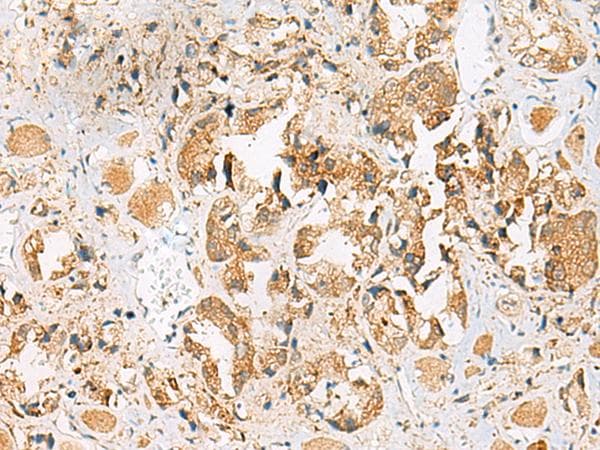 Polyclonal Rabbit anti-Human HEBP1 Antibody (IHC, WB)