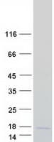 Human LYRM4 Protein (Recombinant Myc-DDK (Flag))