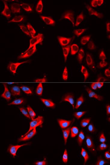 EIF4B Antibody