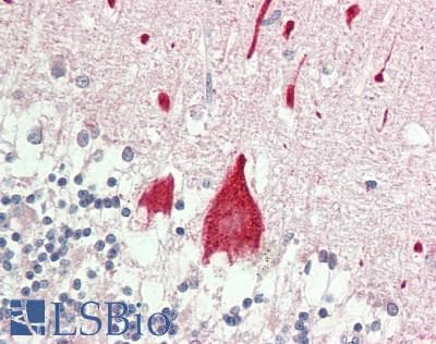 Polyclonal Rabbit anti-Human STYK1 Antibody (aa295-344, IHC, WB)
