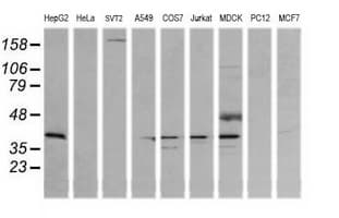MAP2K3 / MEK3 / MKK3 Antibody (clone OTI5C7, Carrier-free)